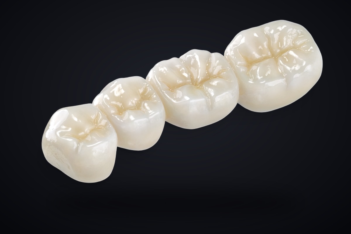 Zirconia & Crown and Bridge