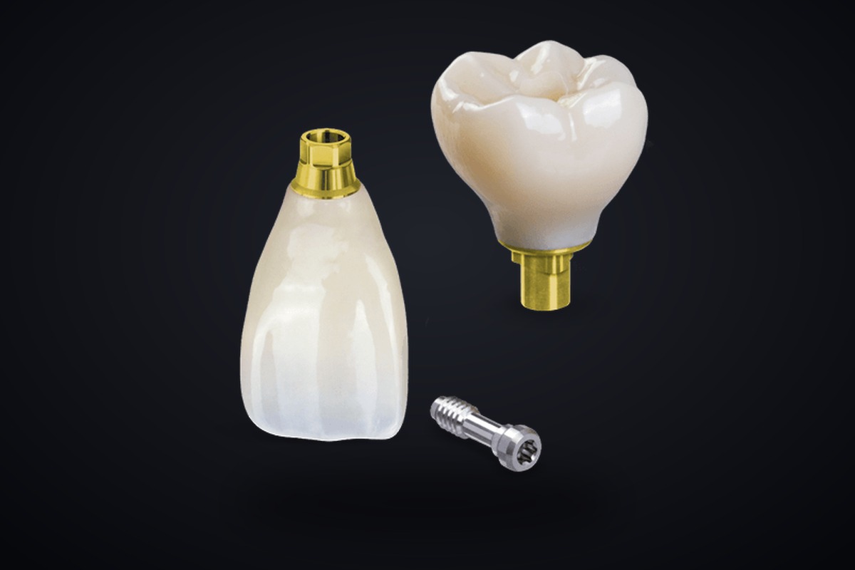 Implant Restorations